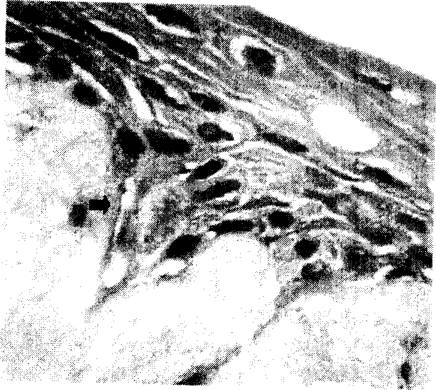 Method for preparing artificial skin used for reparing skin defect