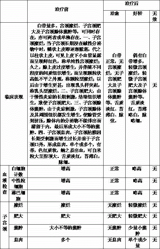 Preparation method of Chinese medicine irrigation solution for treating leucorrhea type chronic cervicitis