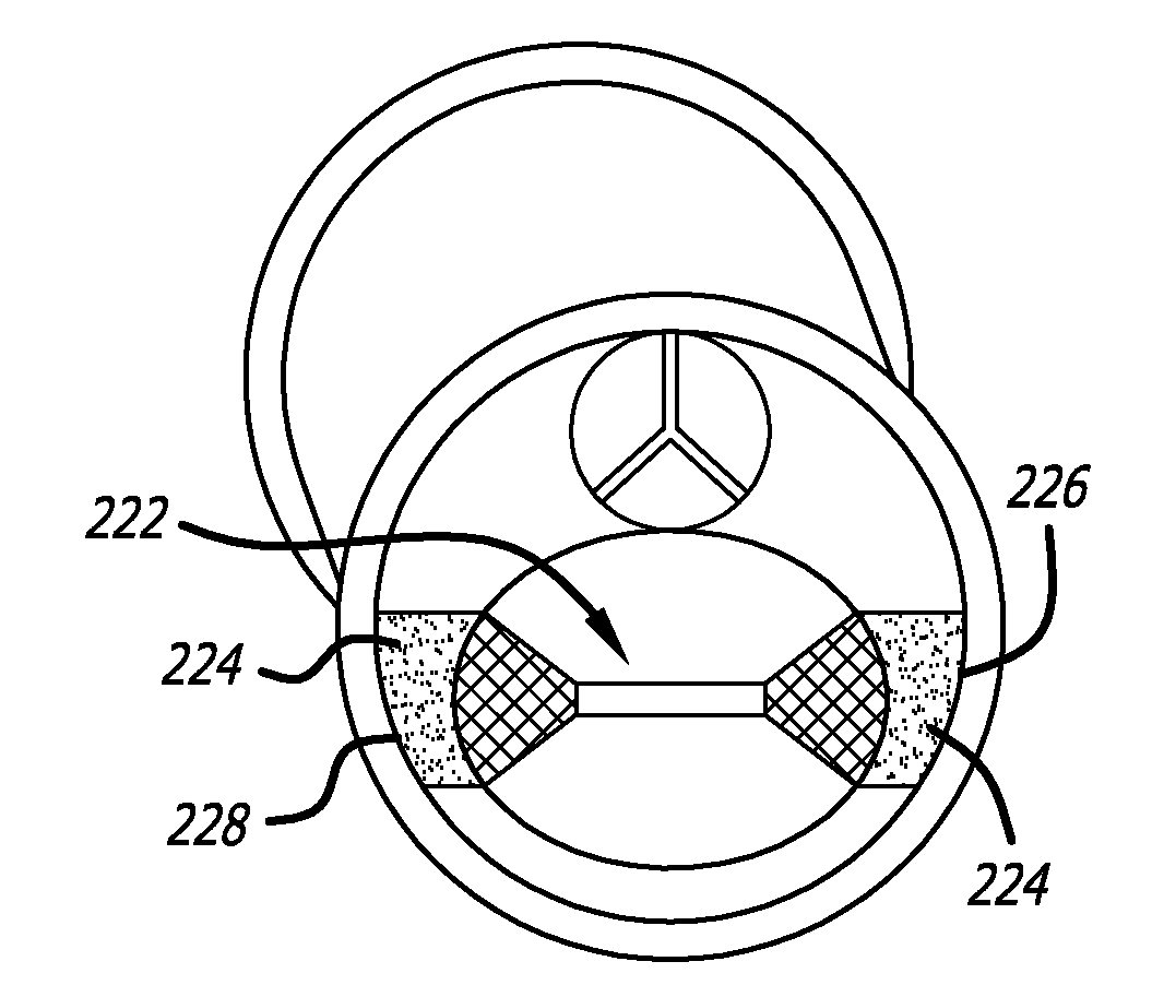 Valve replacement systems and methods