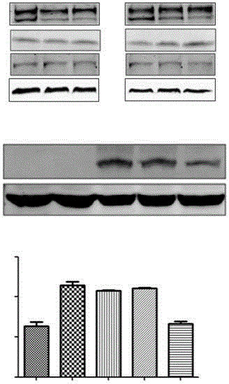 Applications of bruceine D in preparing Wnt/Notch signal channel inhibitor drugs