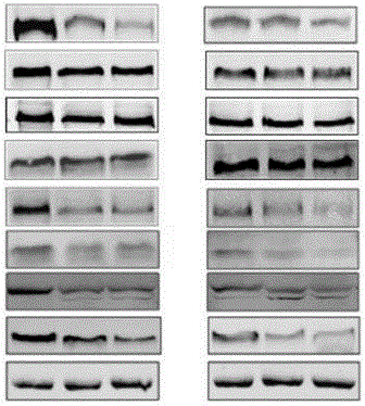 Applications of bruceine D in preparing Wnt/Notch signal channel inhibitor drugs