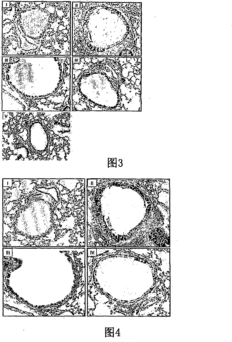 Pharmaceutical composition comprising an extract of pseudolysimachion longifolium and the catalpol derivatives isolated therefrom having antiinflammatory, antiallergic and antiasthmatic activity