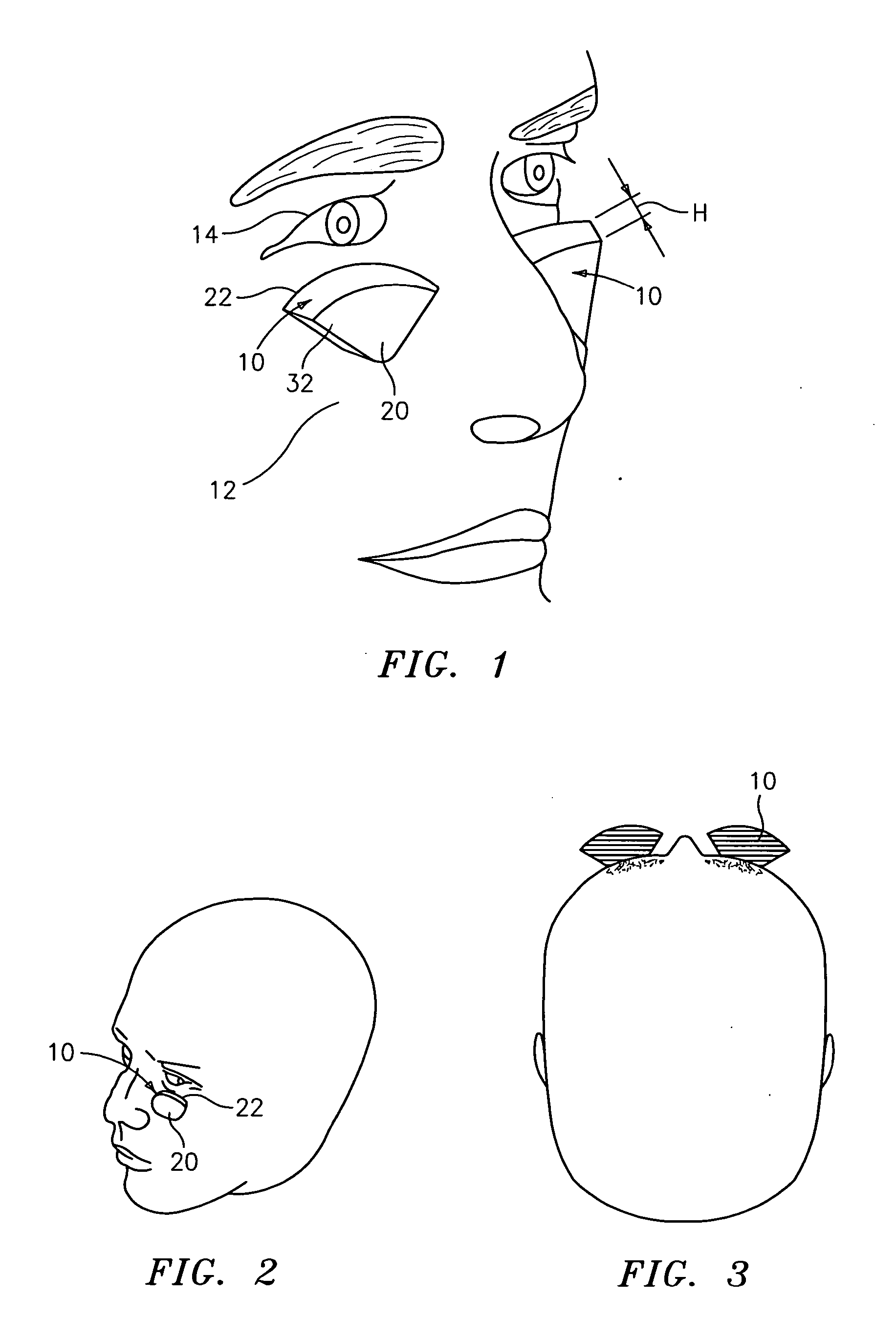 Sports vision training device