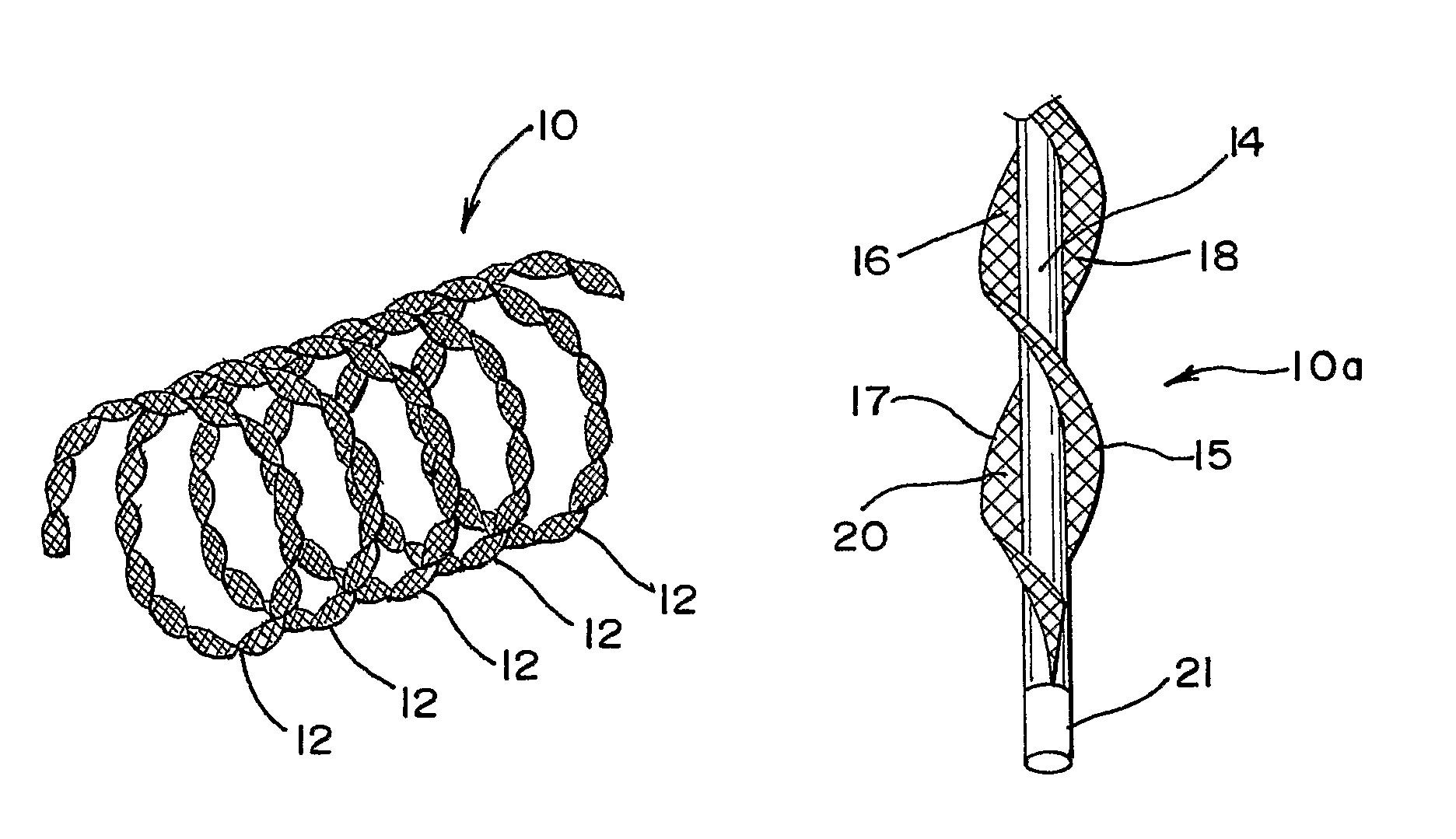 Vascular occlusion device with an embolic mesh ribbon
