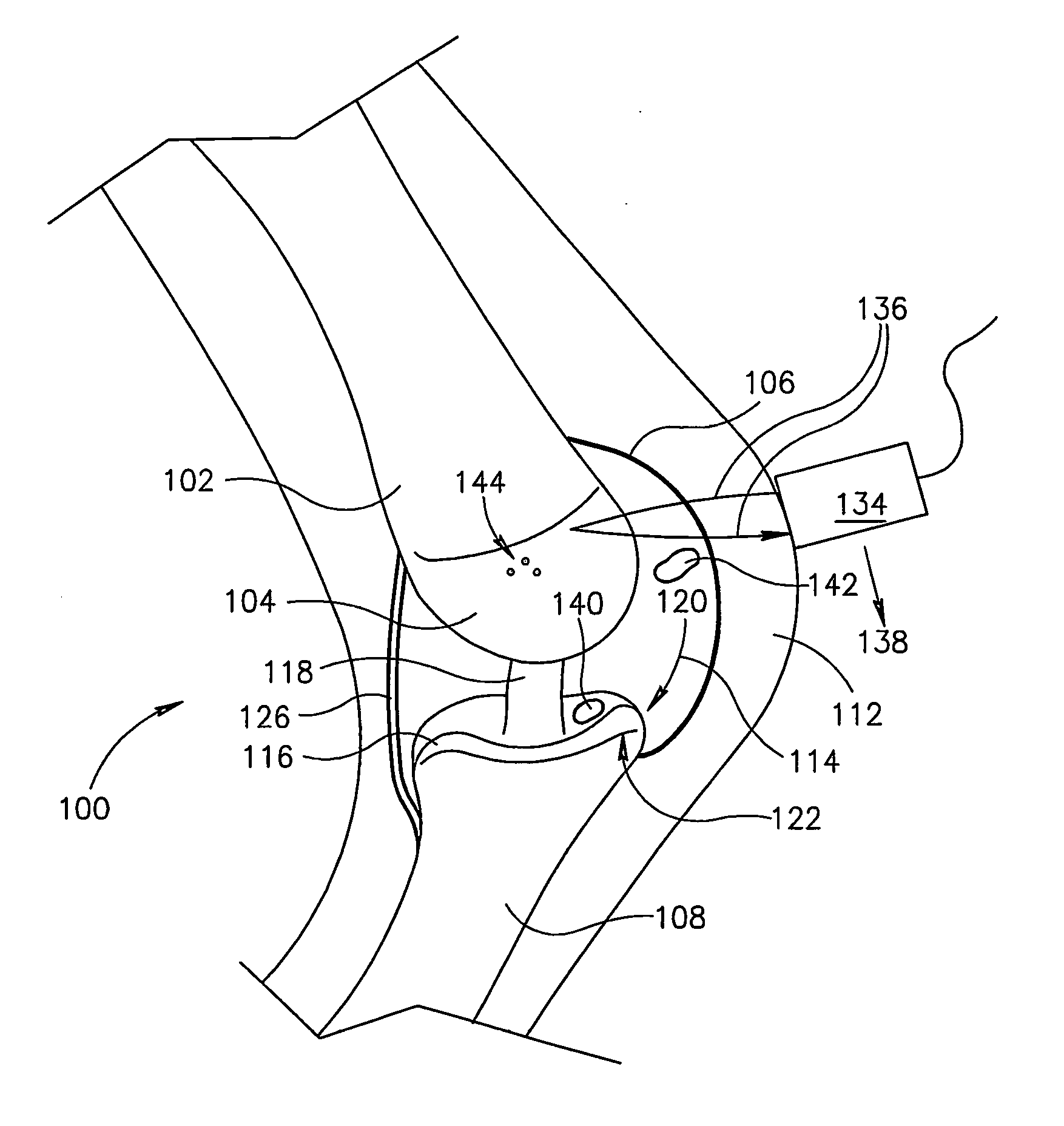 Joint analysis using ultrasound