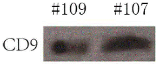 Exosome extraction kit and application thereof in liquid biopsy of diseases including tumors