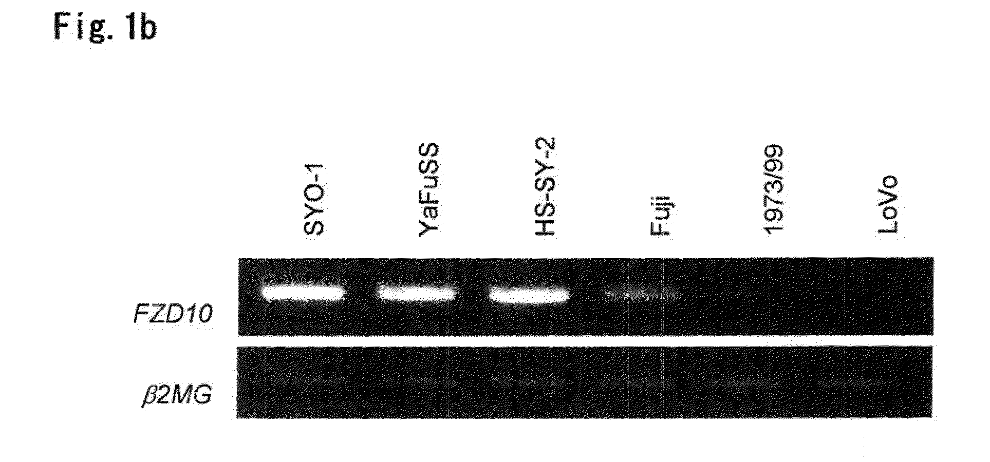 Tumor-Targeting Monoclonal Antibodies to FZD10 and Uses Thereof