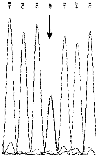 Simple and convenient method and process for detecting SMA by DNA sequencing