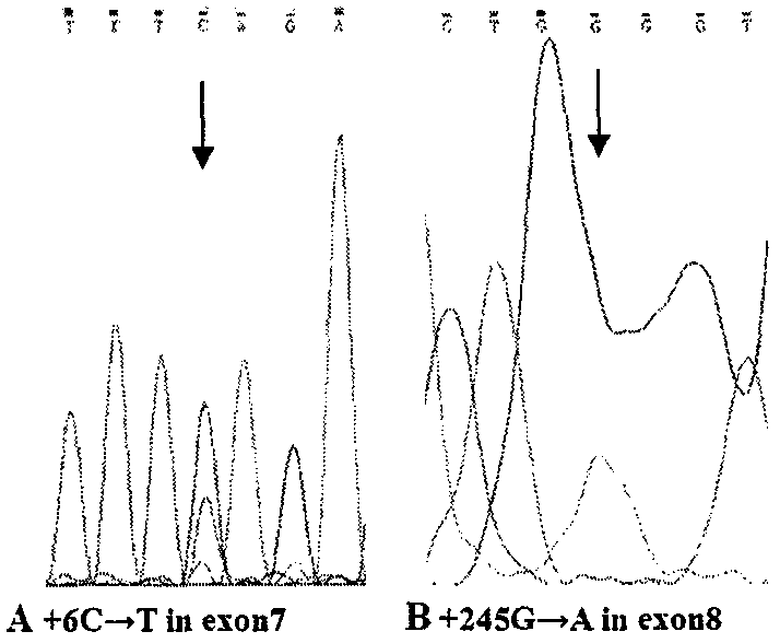 Simple and convenient method and process for detecting SMA by DNA sequencing