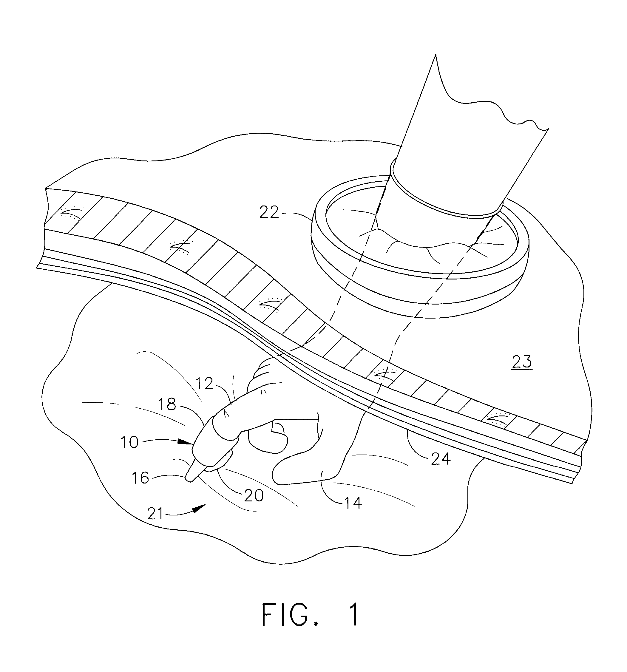 Dispensing Fingertip Surgical Instrument