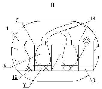 Peritoneum dialysis locator for nephrology