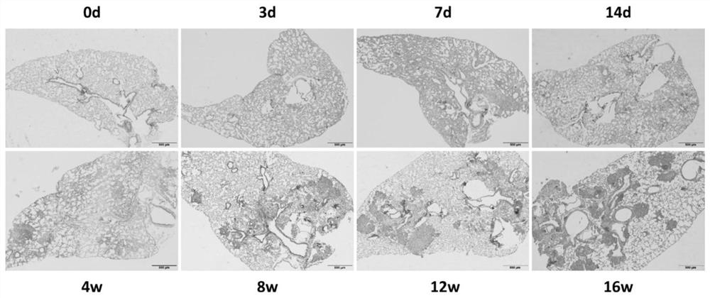 Improved method for preparing mouse silicosis model