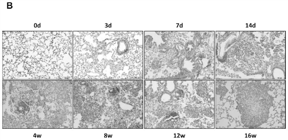 Improved method for preparing mouse silicosis model