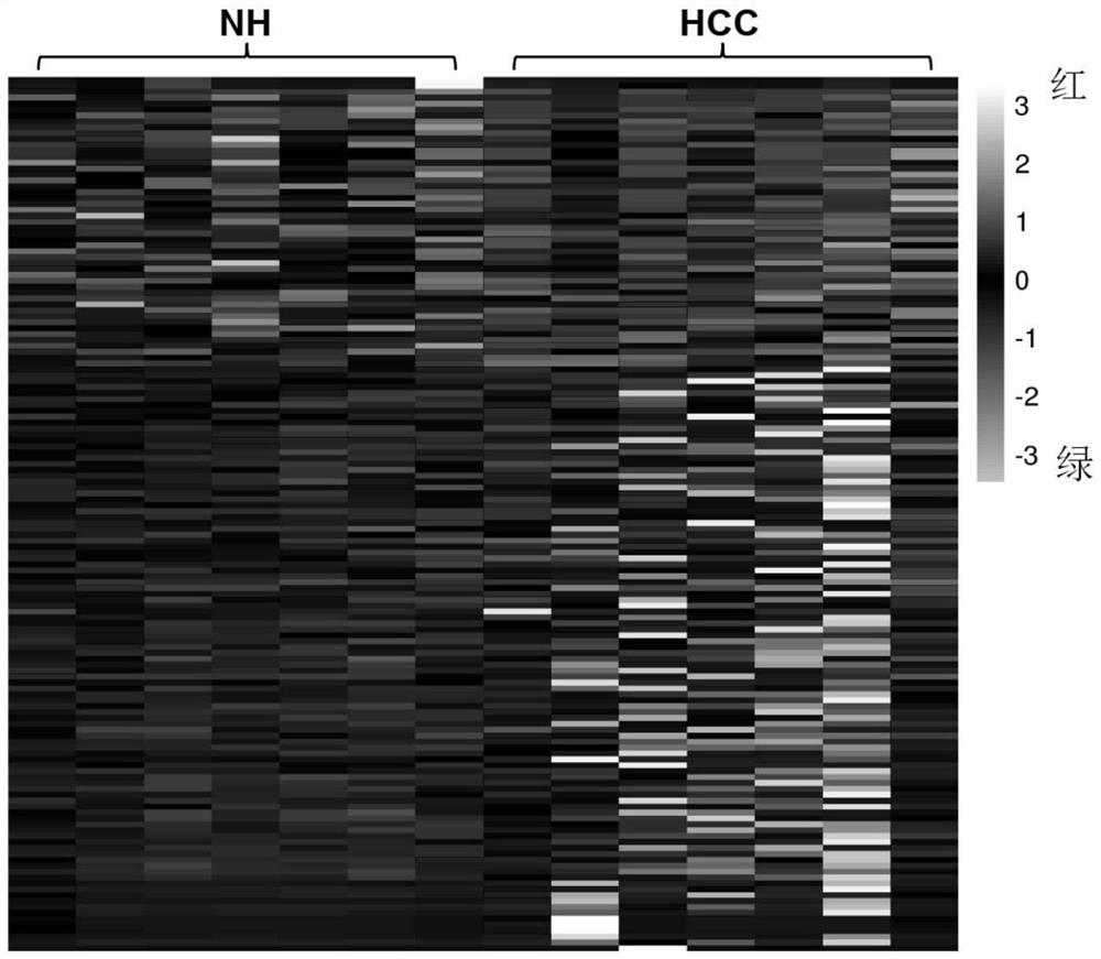 A kind of hepatocellular carcinoma marker and detection kit