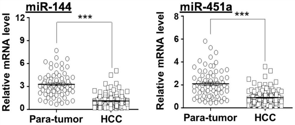 A kind of hepatocellular carcinoma marker and detection kit