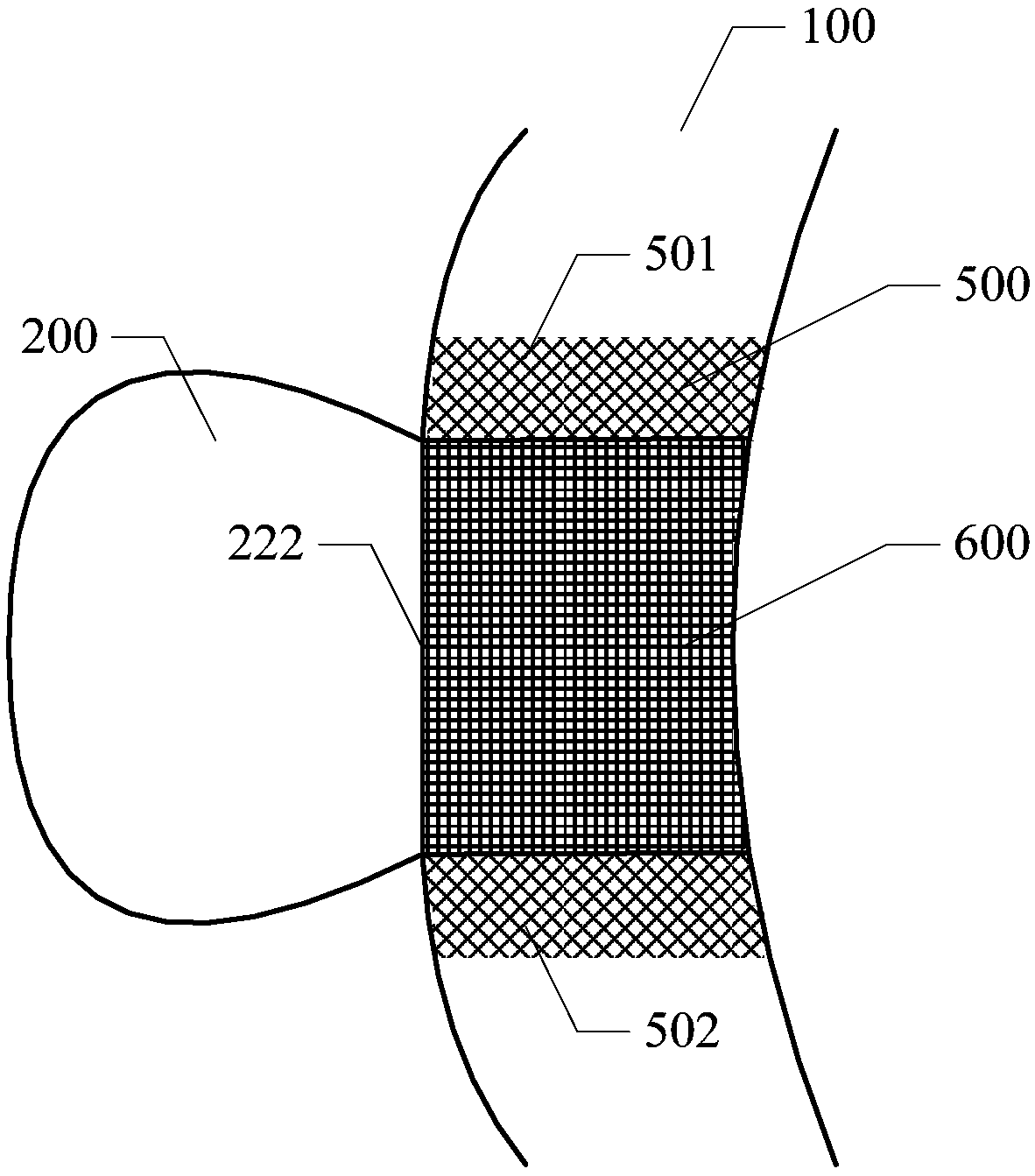 Membrane-coated composite stent