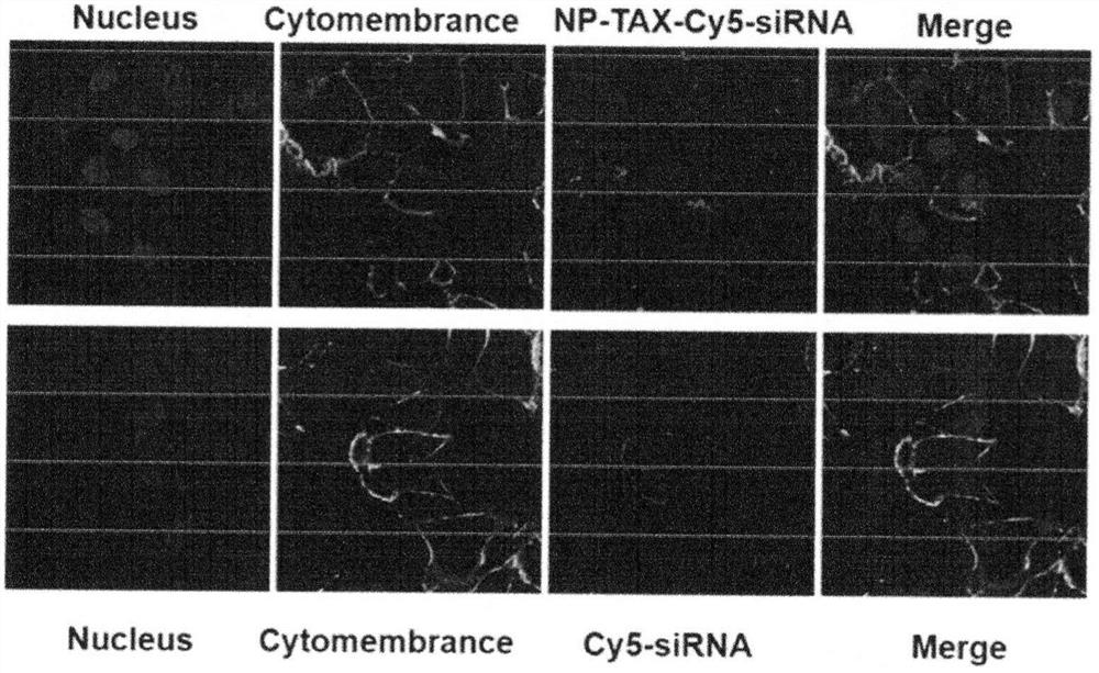 Preparation method of tumor-targeting nanoparticle carrier co-loaded with breast cancer chemotherapy drug mtdh siRNA