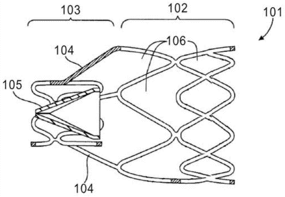 Unidirectional flap