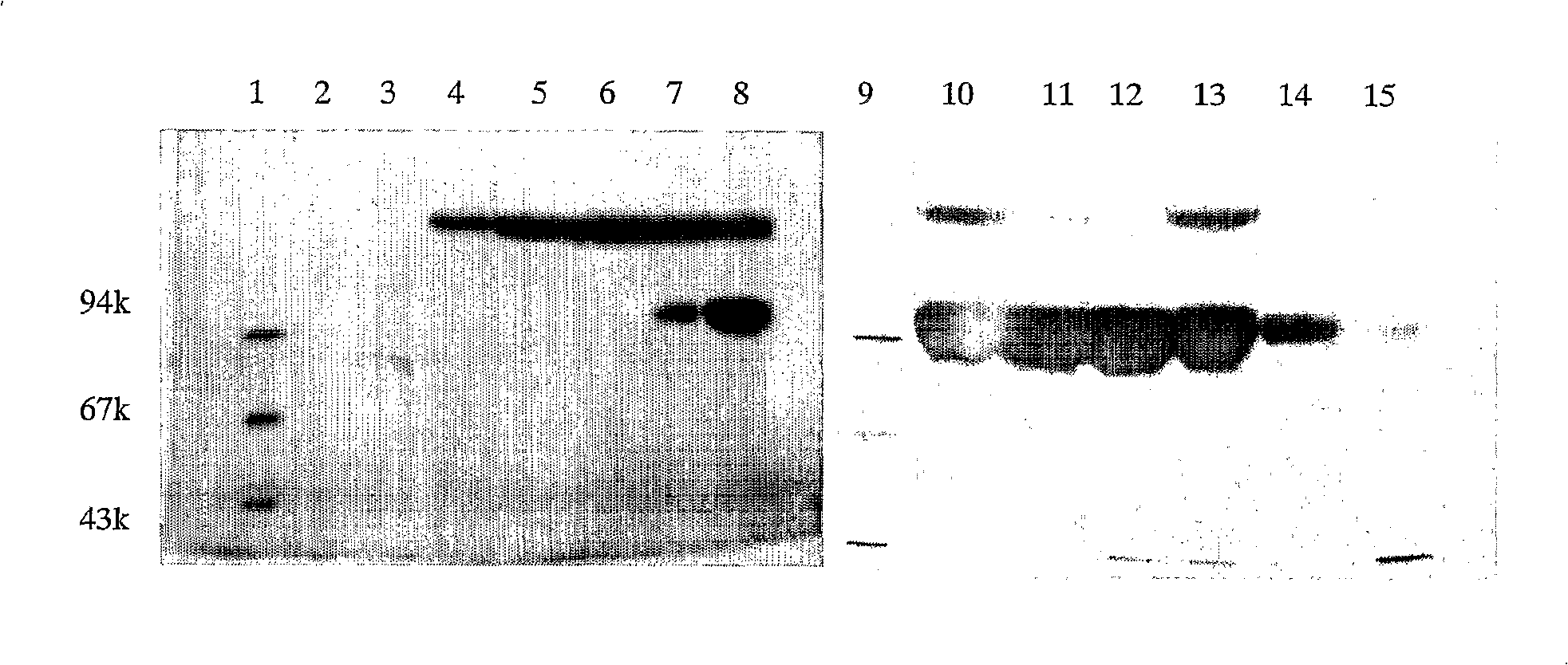 Interleukin-6 polyethylene glycol conjugate and its preparing method and use