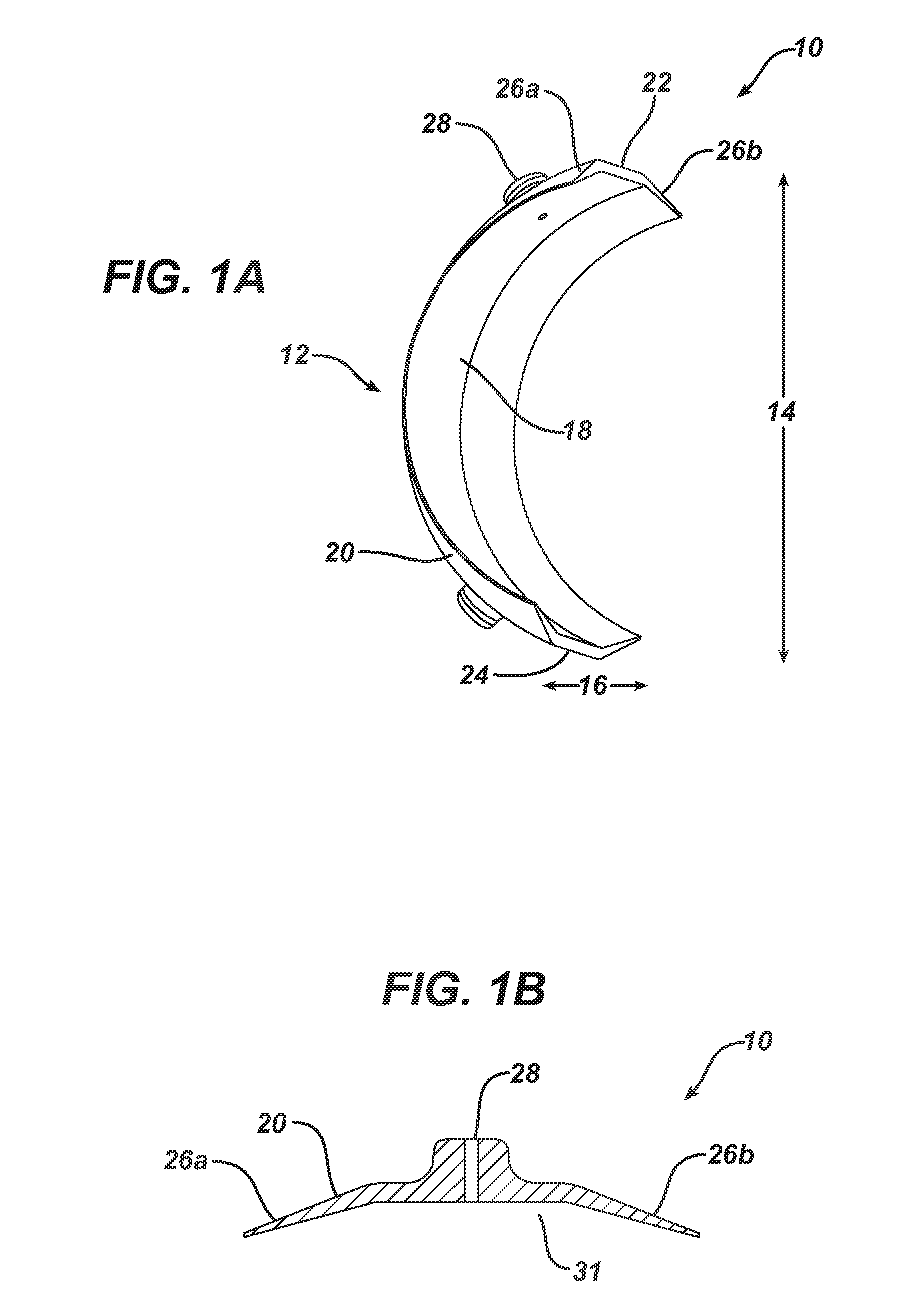 Device and method for the application of a curable fluid composition to a bodily organ