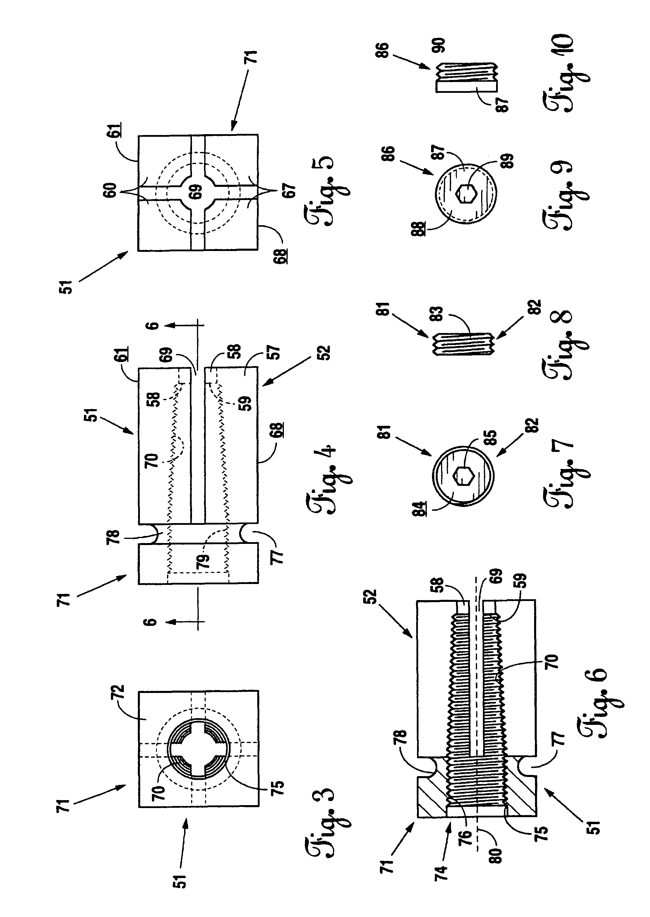 Expandable lordosis stabilizing cage