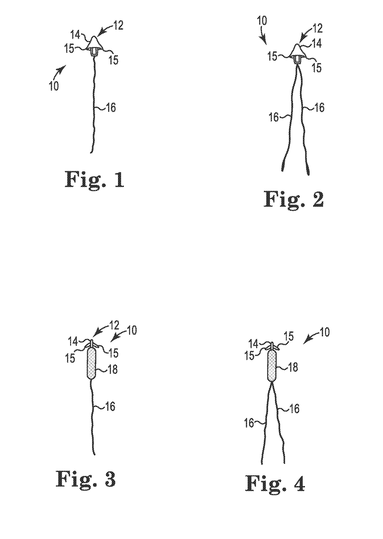 Transperitoneal prolapse repair system and method