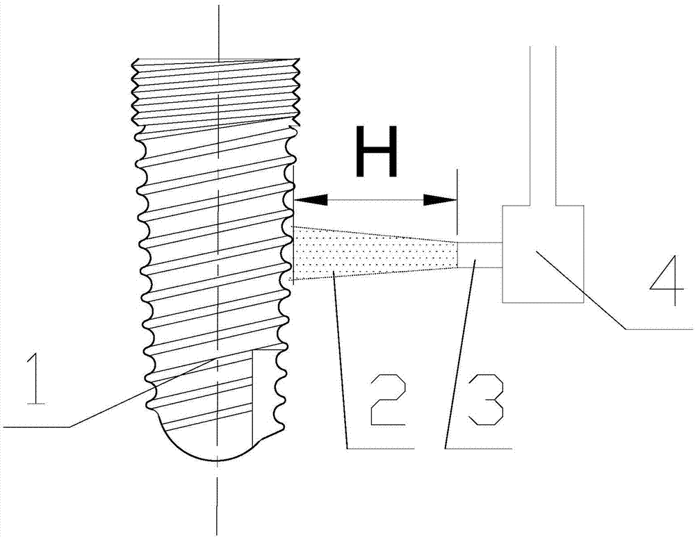 Surface treatment method of zirconia implant