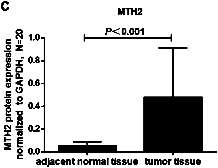 Marker for determining prognosis of colorectal cancer and application thereof