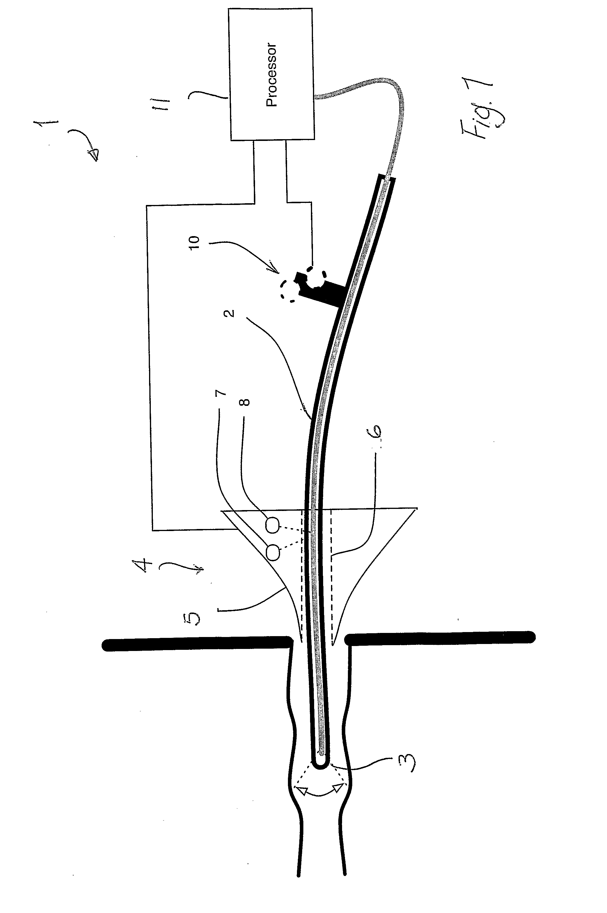 Endoscopy system with motion sensors