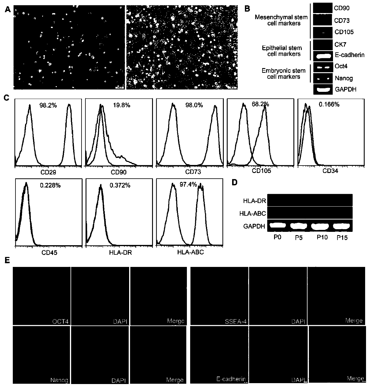 Method for induced differentiation of amnion epithelial stem cells into functional pancreatic beta cells as well as application of induced differentiation