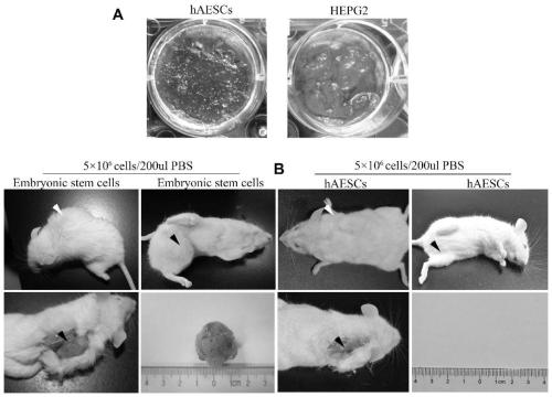 Method for induced differentiation of amnion epithelial stem cells into functional pancreatic beta cells as well as application of induced differentiation