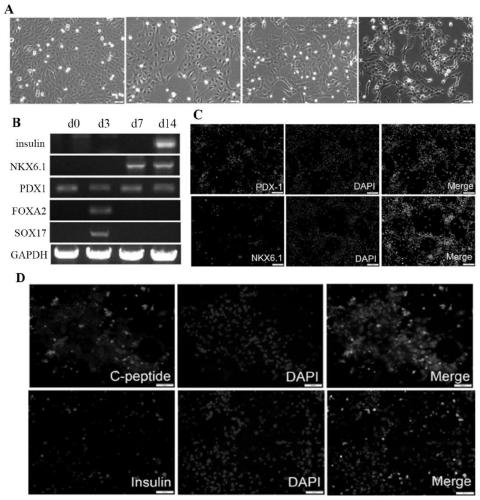 Method for induced differentiation of amnion epithelial stem cells into functional pancreatic beta cells as well as application of induced differentiation