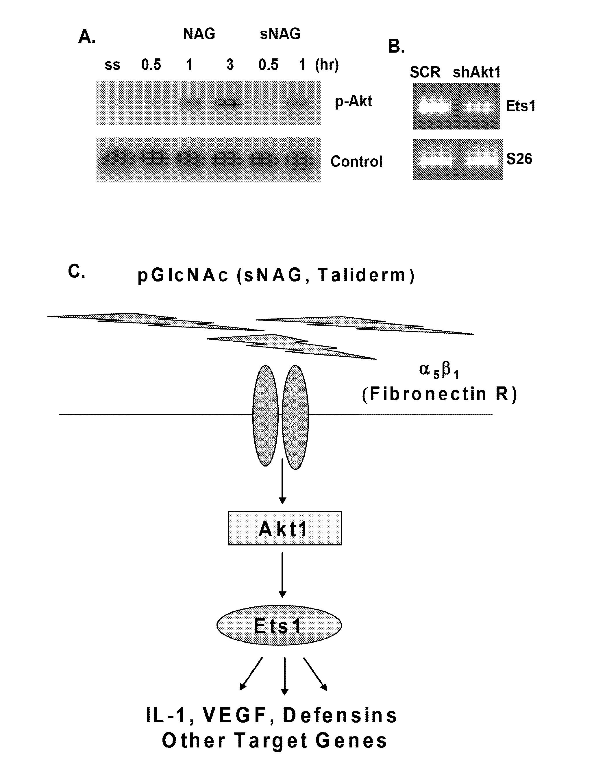 Treatment of disease with poly-n-acetylglucosamine nanofibers