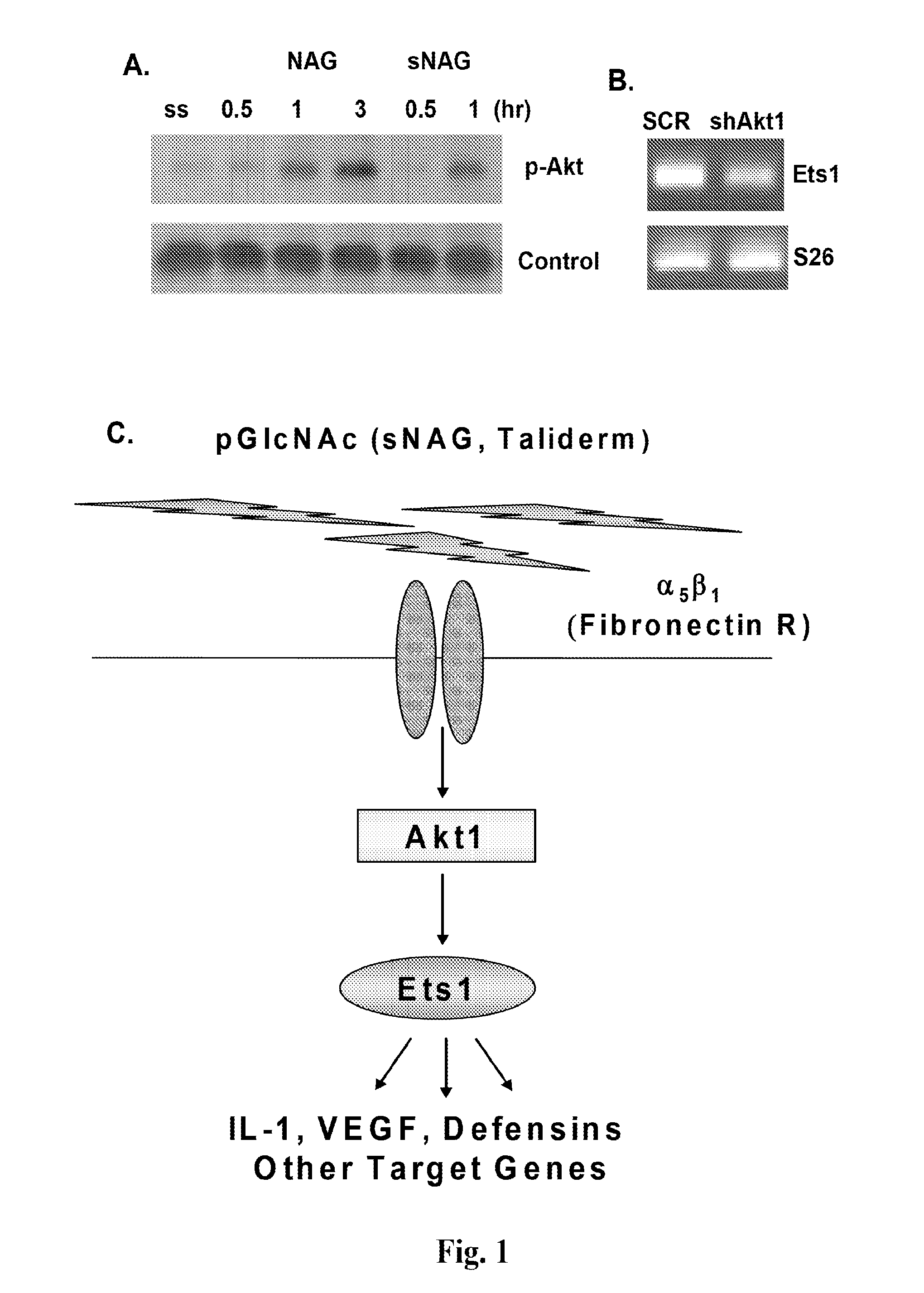 Treatment of disease with poly-n-acetylglucosamine nanofibers