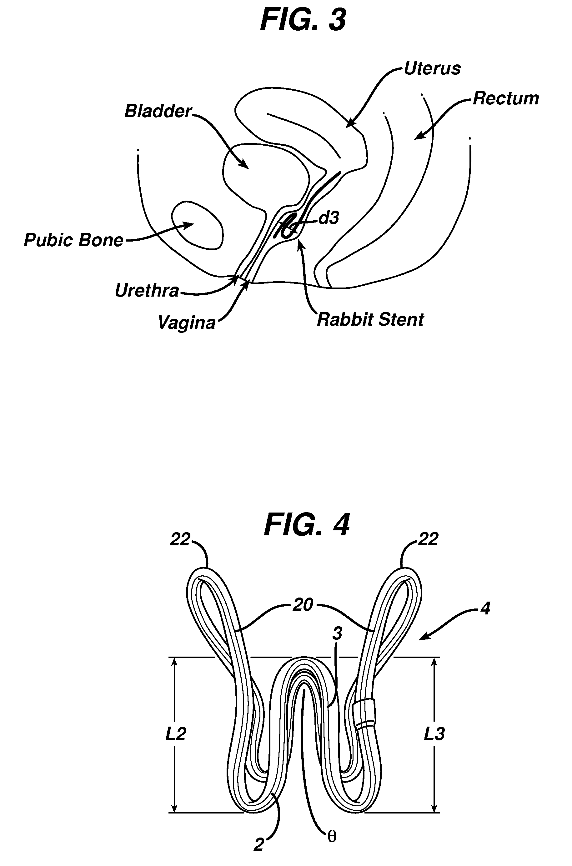 Resilient device