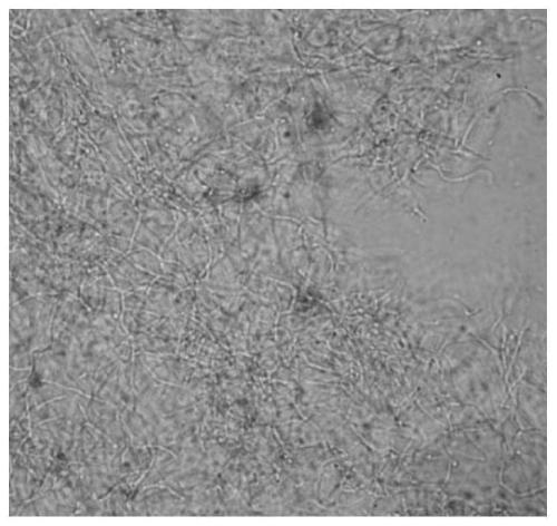 Plant pathogen inhibitor and strain involved therein and application of plant pathogen inhibitor