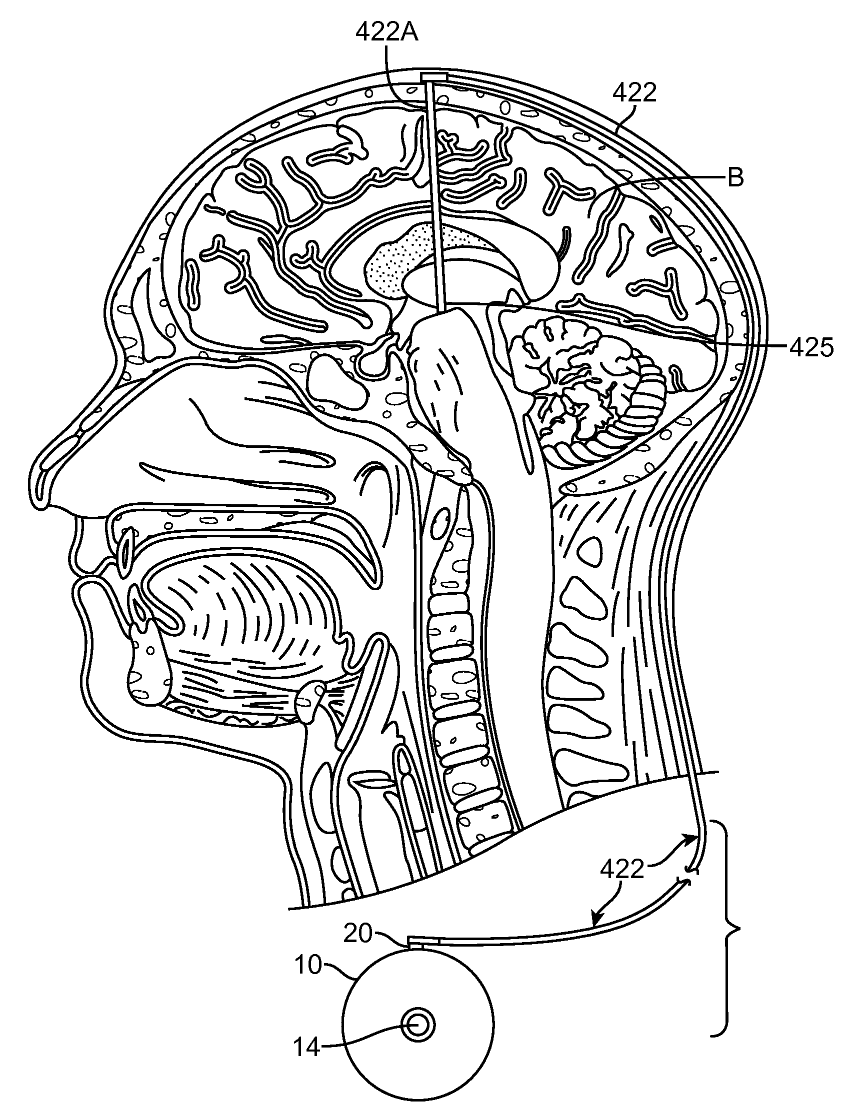 Cognitive function within a human brain