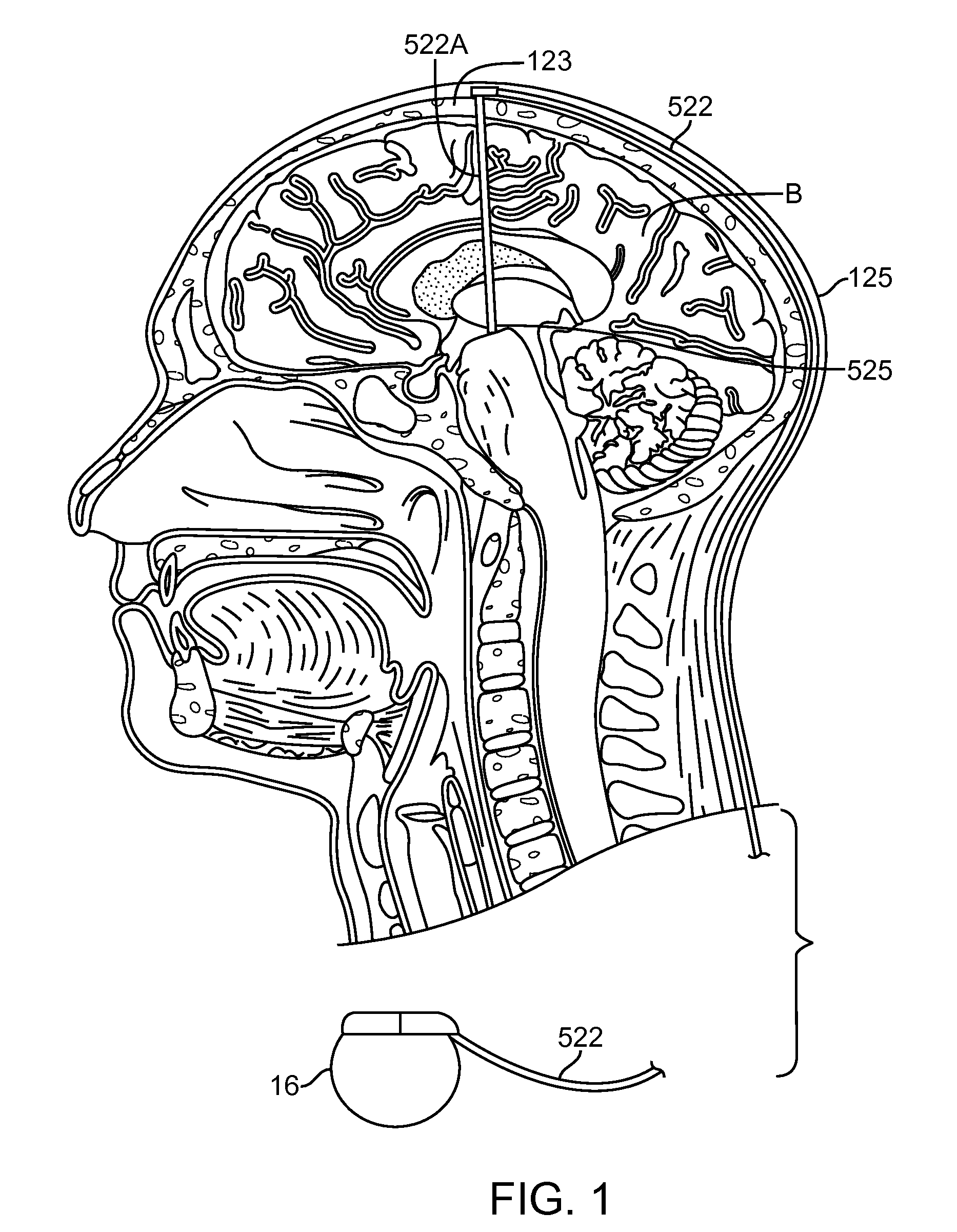 Cognitive function within a human brain