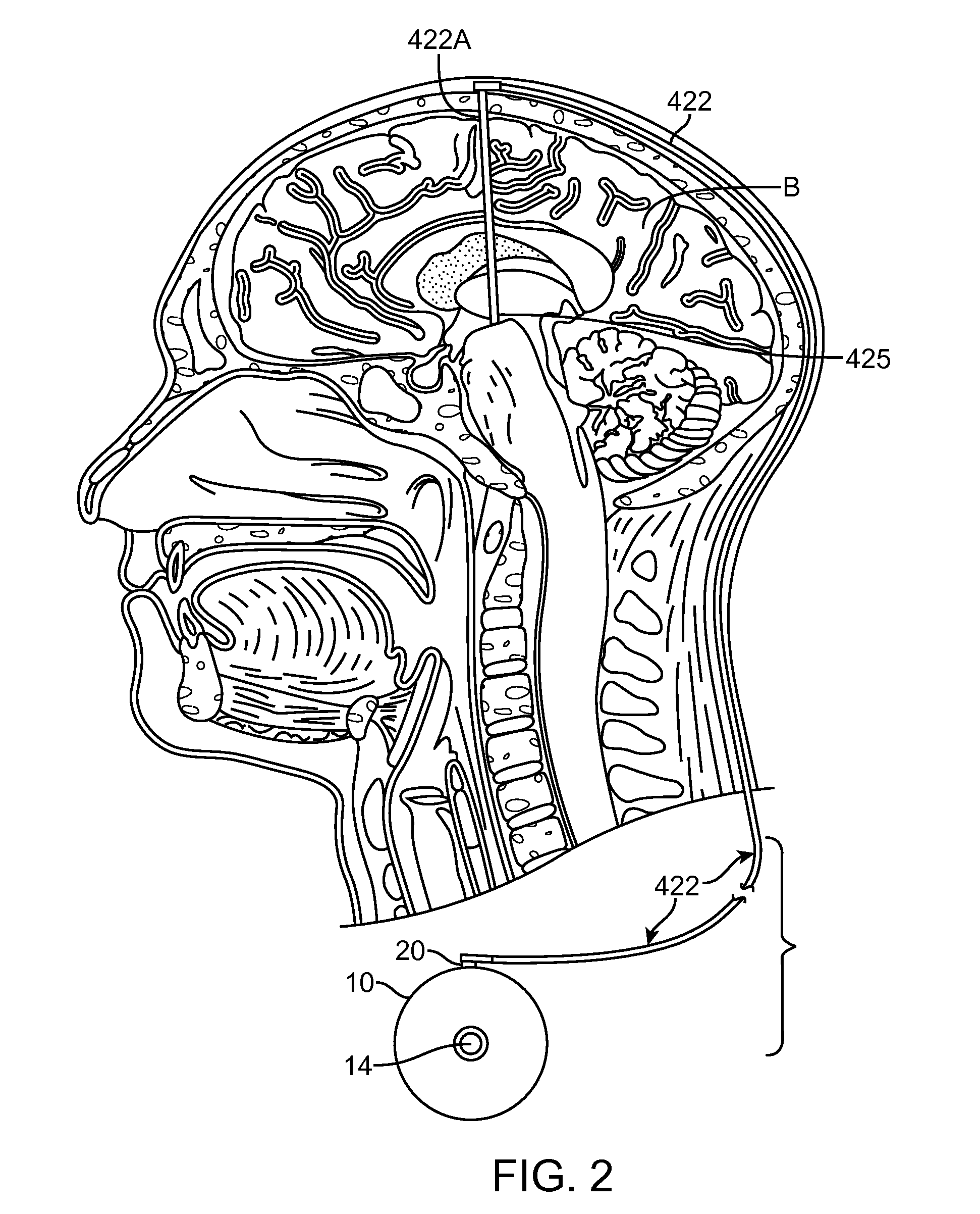 Cognitive function within a human brain