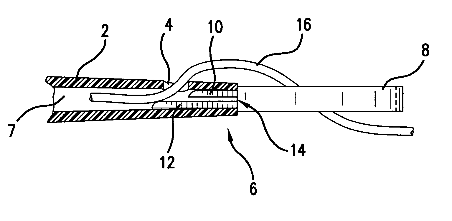 Universal percutaneous endoscopic gastrostomy tube