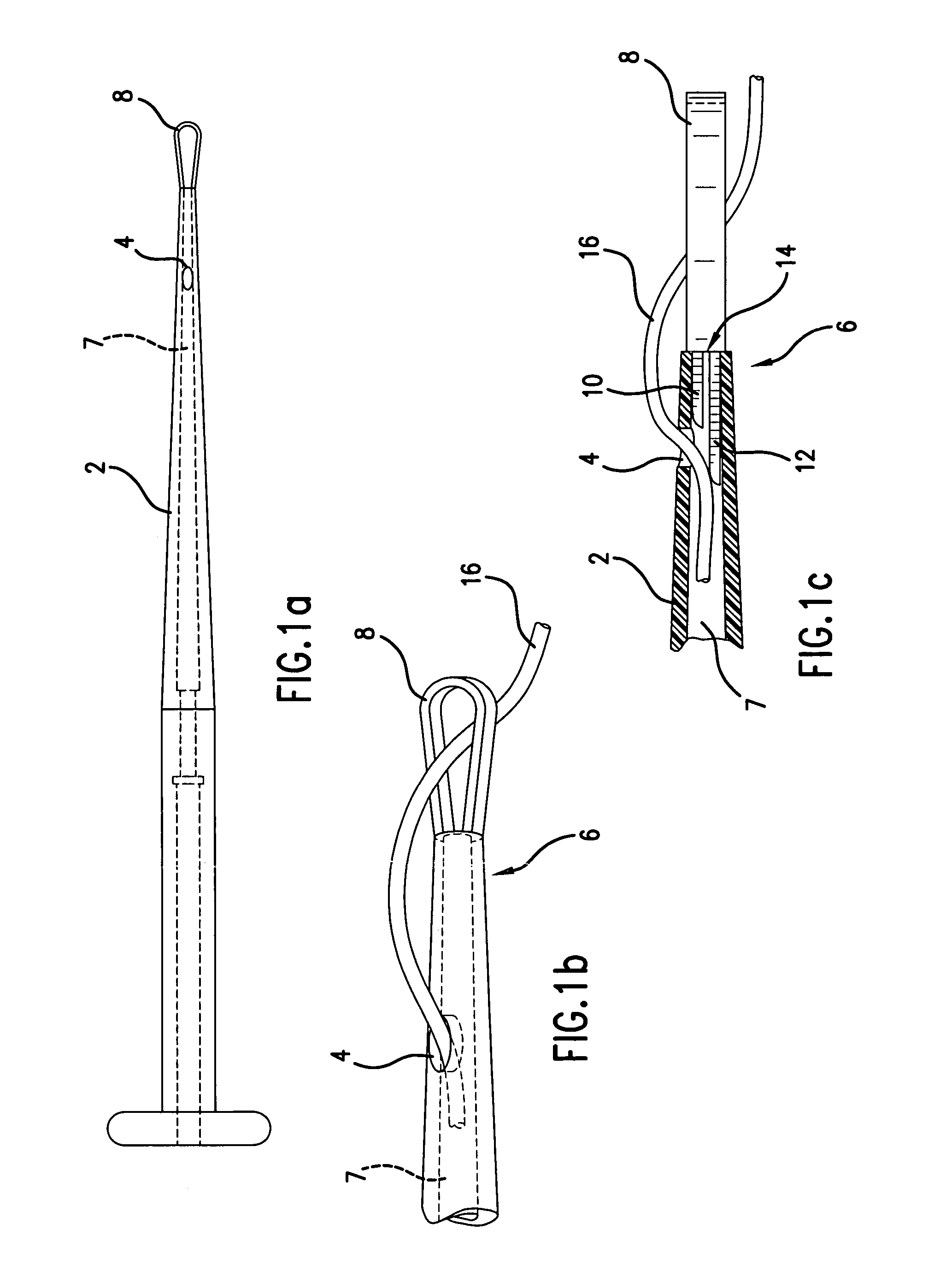 Universal percutaneous endoscopic gastrostomy tube