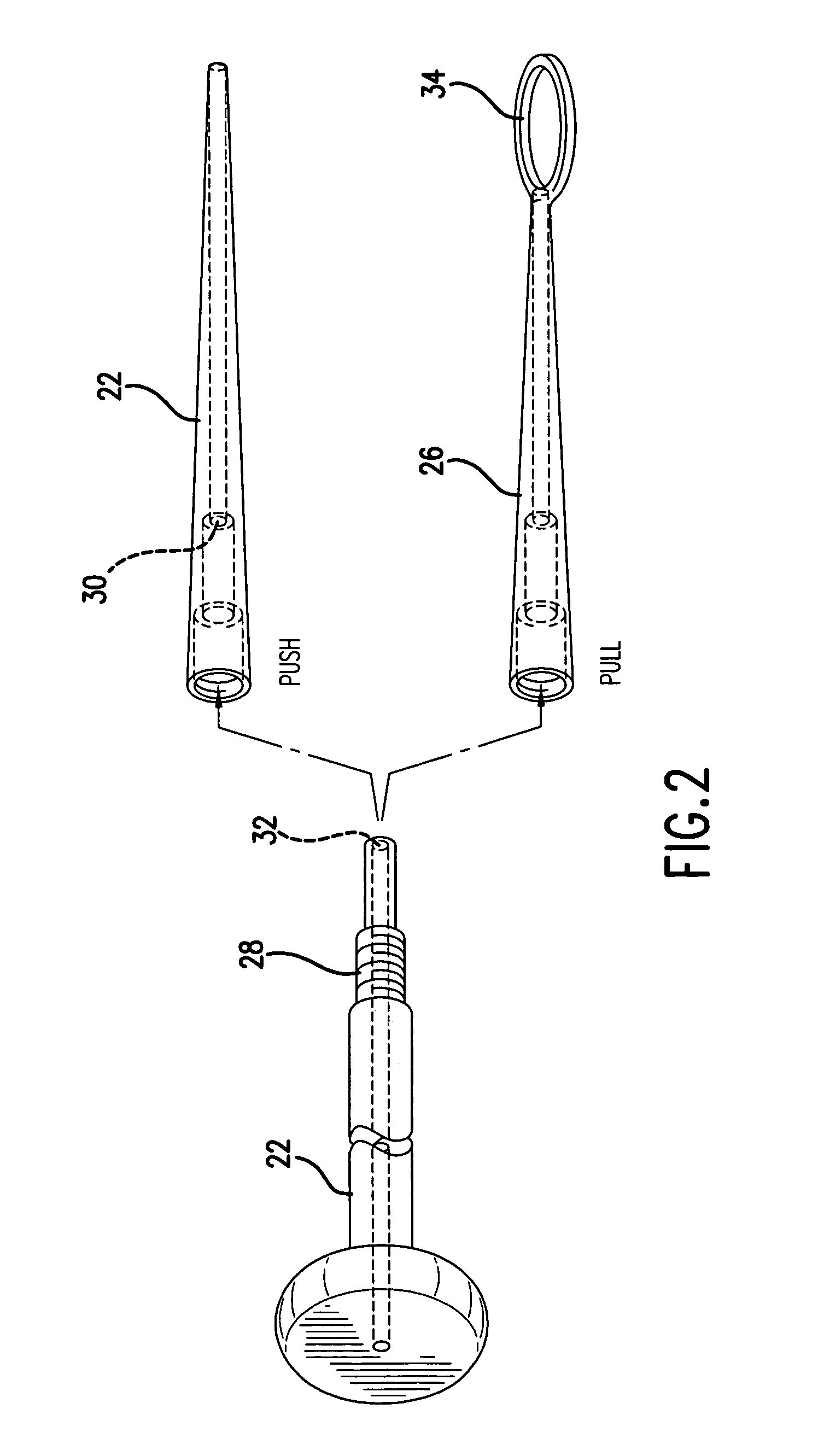 Universal percutaneous endoscopic gastrostomy tube