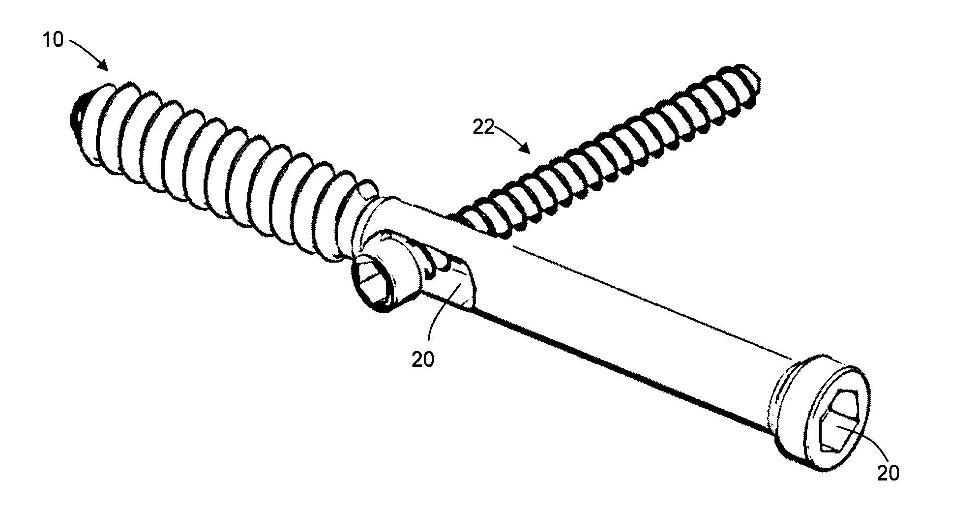 Bone screw, and bone fixation system and method