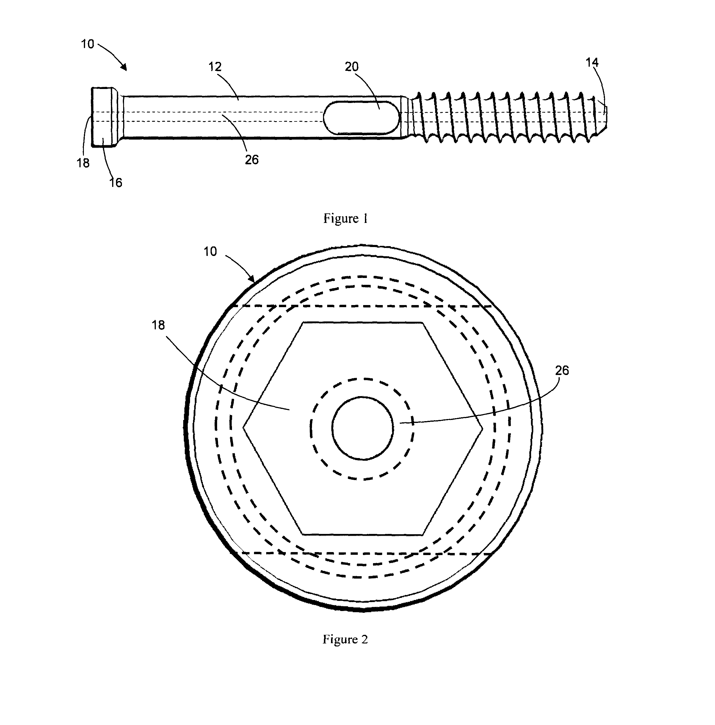 Bone screw, and bone fixation system and method