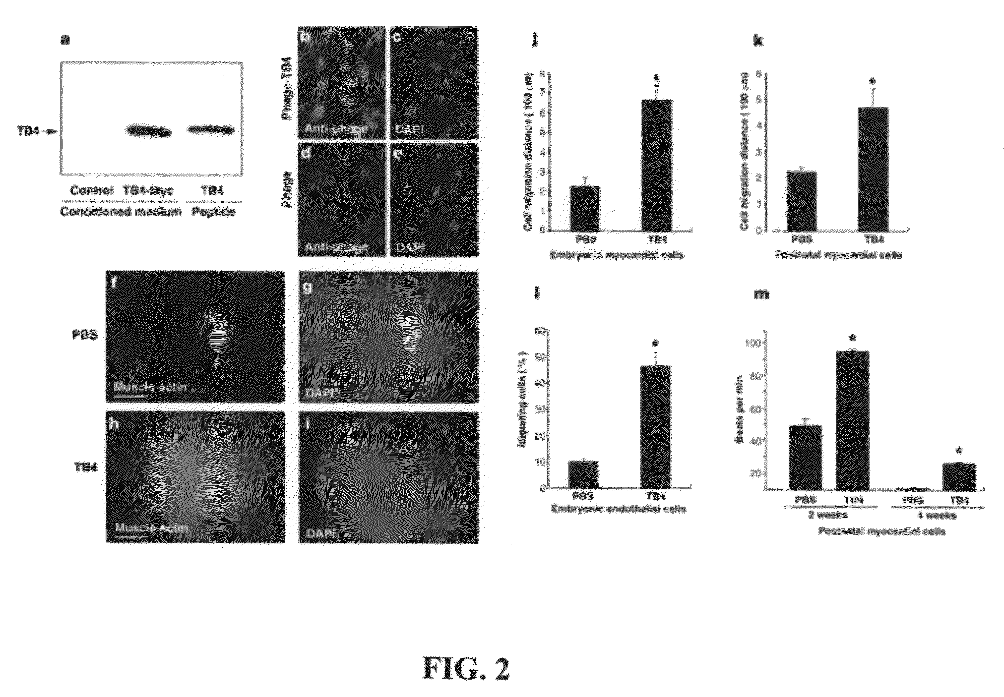 Screening of agents for activity against ischemic myocardial insults