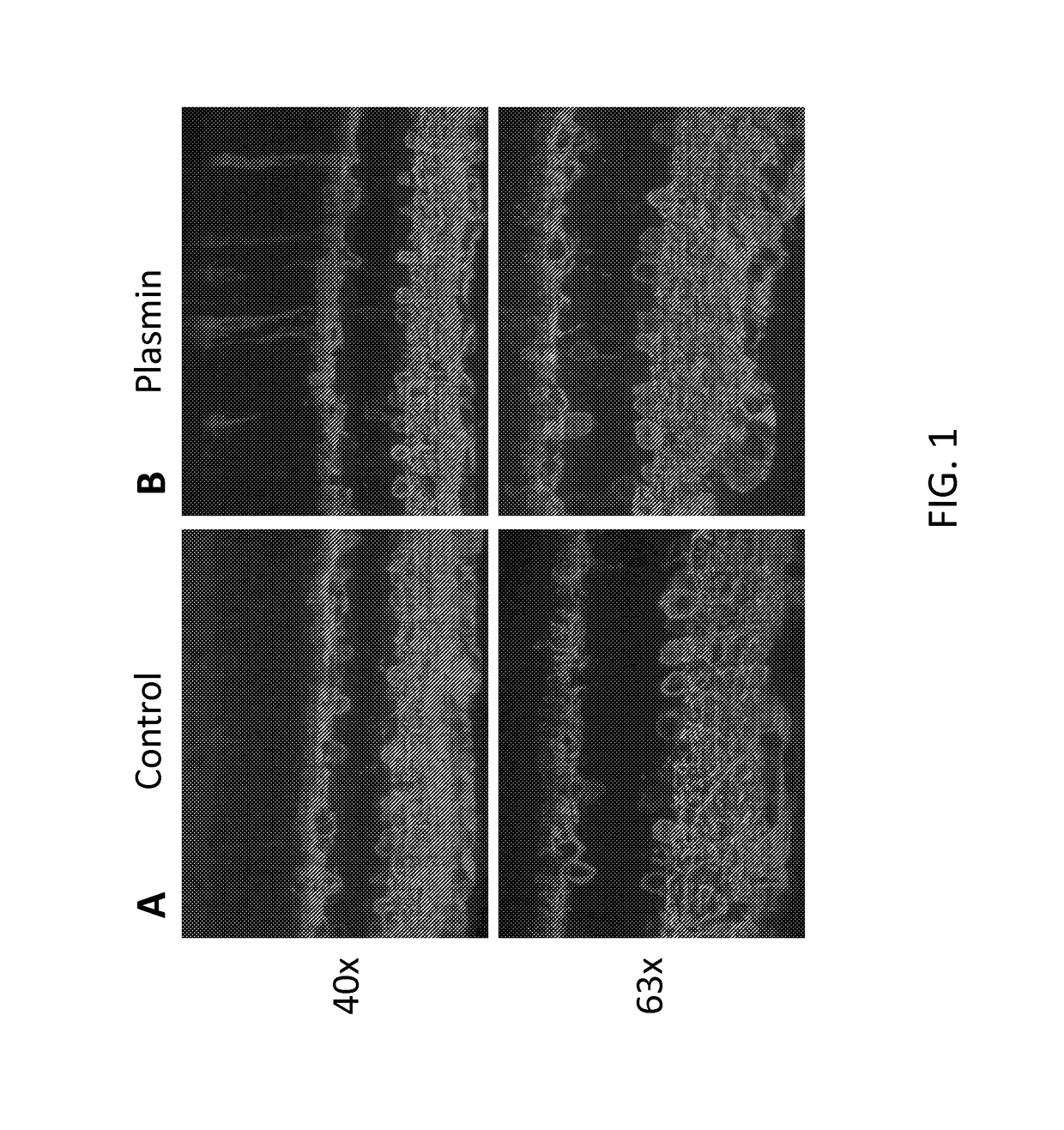 Method of enhancing delivery of therapeutic compounds to the eye