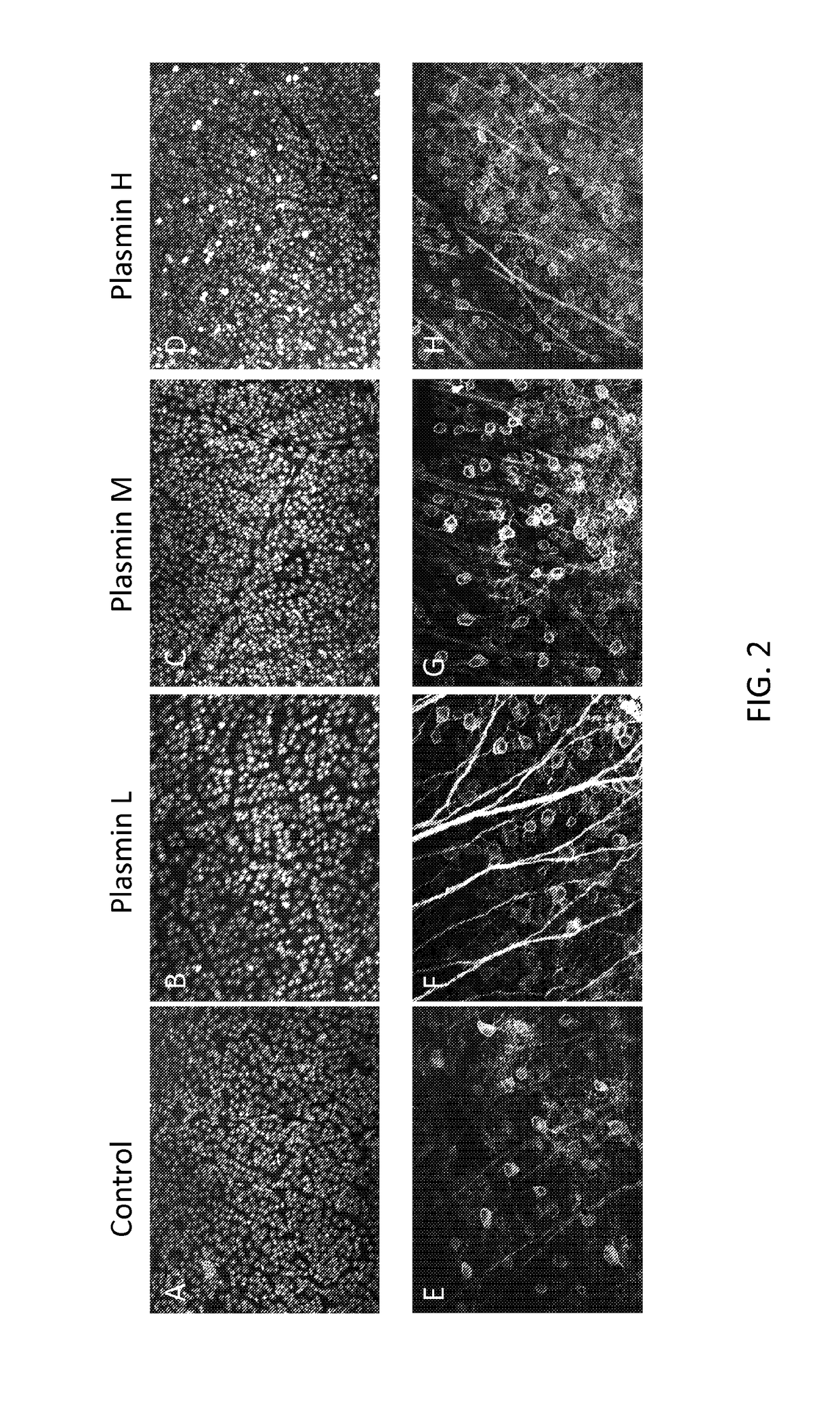 Method of enhancing delivery of therapeutic compounds to the eye