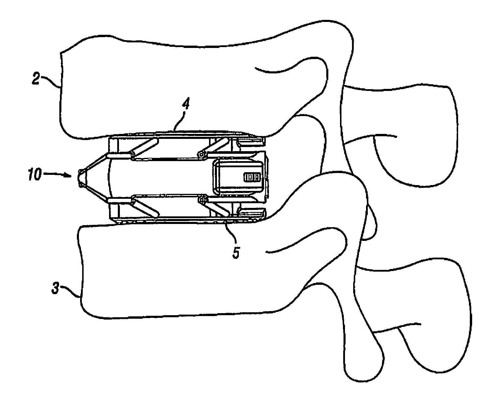 Expandable Fusion Device and Method of Installation Thereof