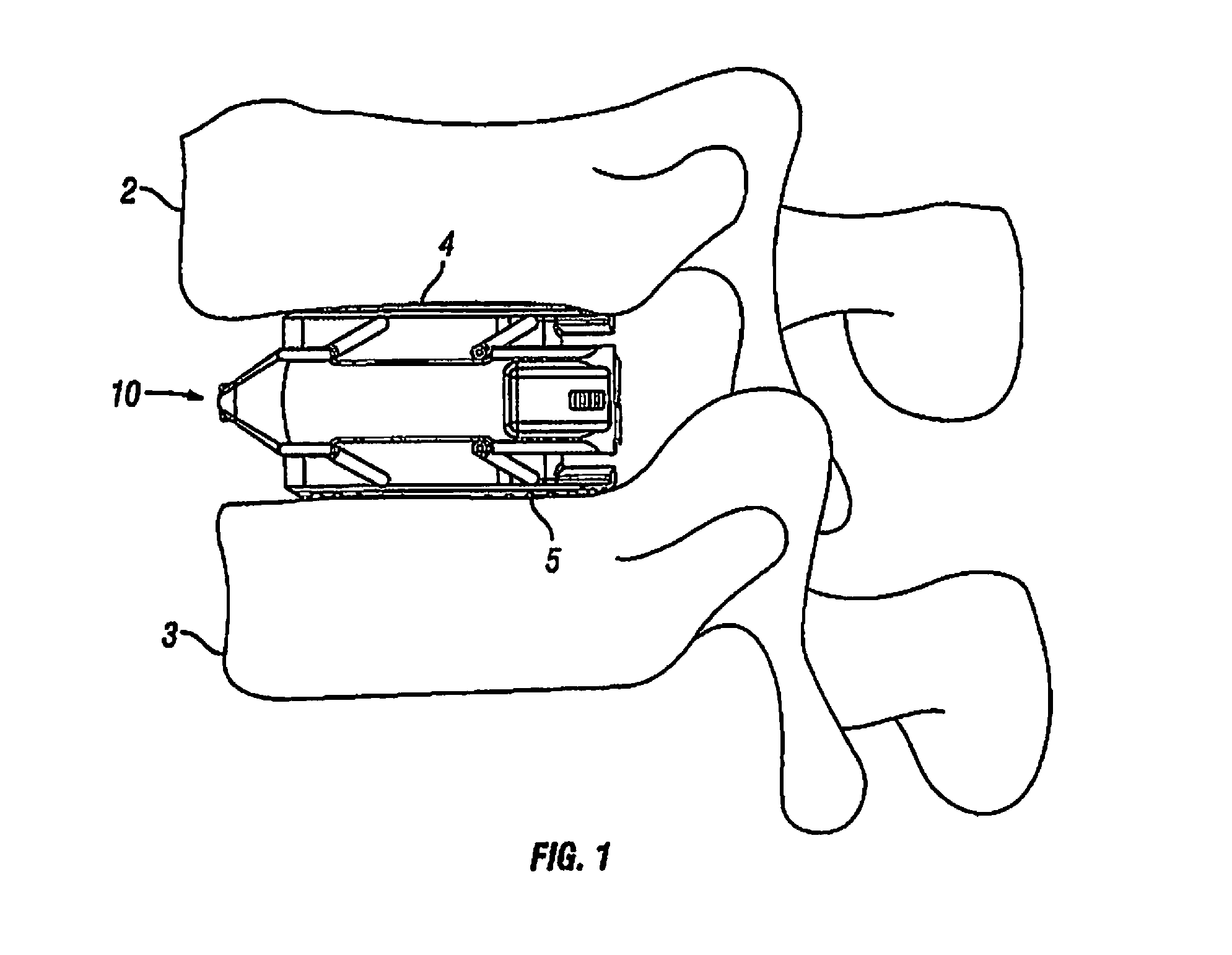 Expandable Fusion Device and Method of Installation Thereof