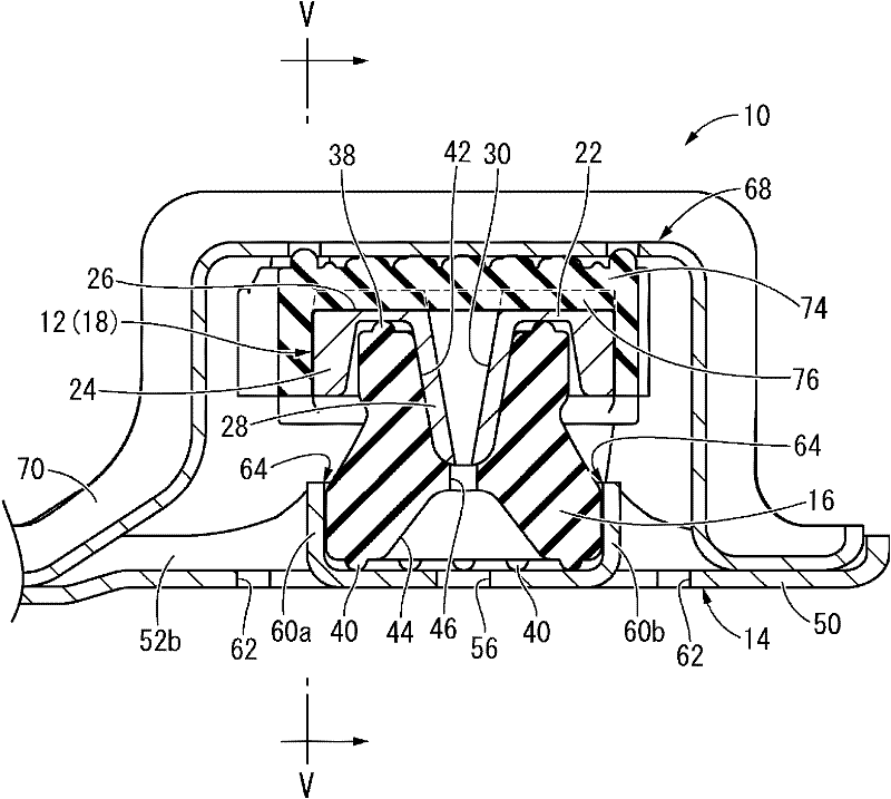 Anti-vibration device